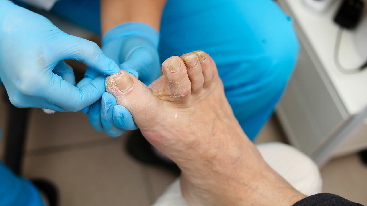 Doctor examining toe